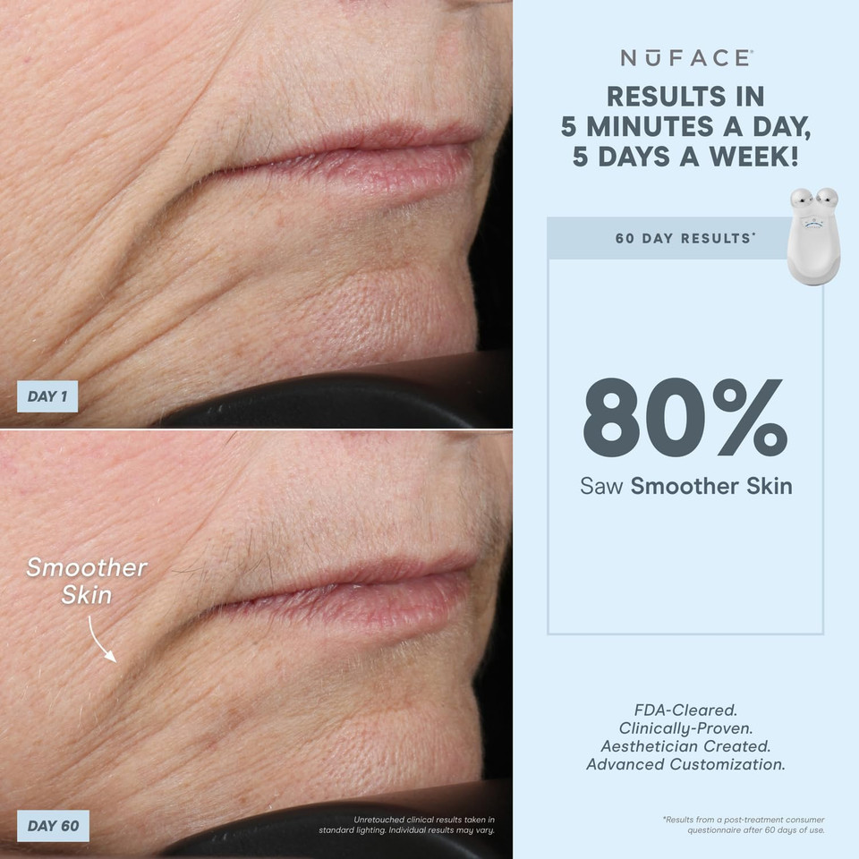 Nuface Effective Lip & Eye Attachment For Trinity Microcurrent Facial Device, Fda Cleared - Depuffing, Line Smoothing, Plumping & Tightening Treatment For Hard-To-Reach Areas Around Mouth And Eyes Nuface Effective Lip & Eye Attachment For Trinity Microcurrent Facial Device, Fda Cleared - Depuffing, Line Smoothing, Plumping & Tightening Treatment For Hard-To-Reach Areas Around Mouth And Eyes