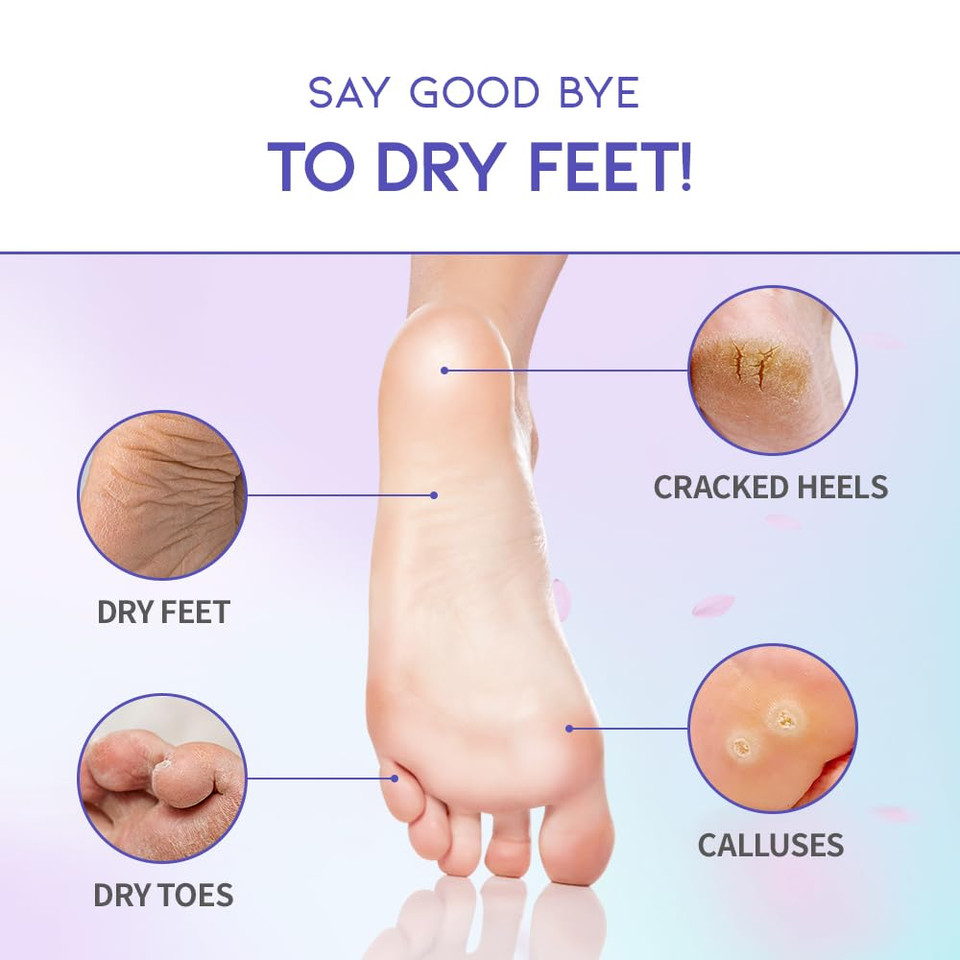 Foot Peel Mask Korean For Dry Cracked Feet Aha Bha Lavendar Aroma Therapy Vegan Exfoliating Moisturizing Baby Foot Mask Socks Booties, 30 Minute Quick Foot Mask 2 Pack2 Pack
