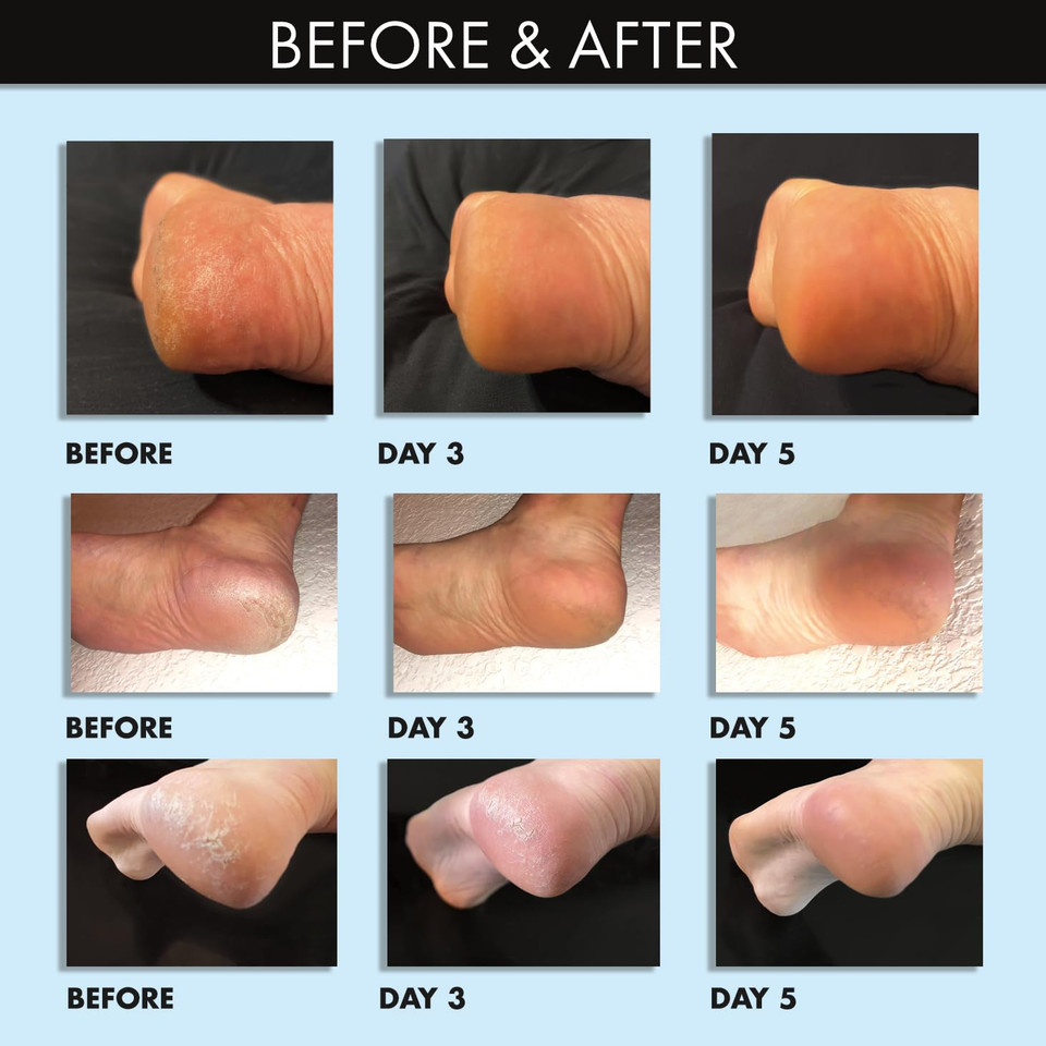 Whish Coconut Milk + Verbena Exfoliating Foot Mask - Smoothes & Softens, Intense Hydration