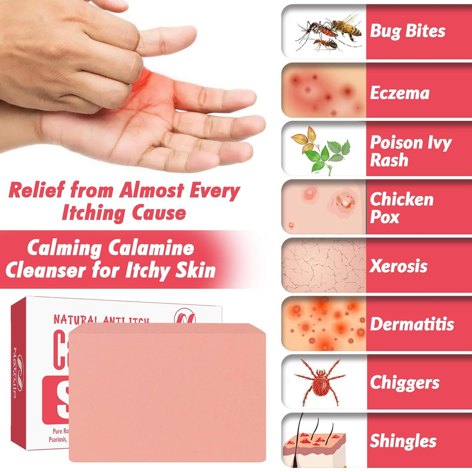 Natural Fast Acting Itch Relief Soap Bar - Calming Calamine Soap For Itchy Skin, Insect Bite, Eczema, Ivy Rash, Chicken Pox - Pure Raw Anti-Itch Defense Cleansing Skincare - Made In Usa Natural Fast Acting Itch Relief Soap Bar - Calming Calamine Soap For Itchy Skin, Insect Bite, Eczema, Ivy Rash, Chicken Pox - Pure Raw Anti-Itch Defense Cleansing Skincare - Made In Usa