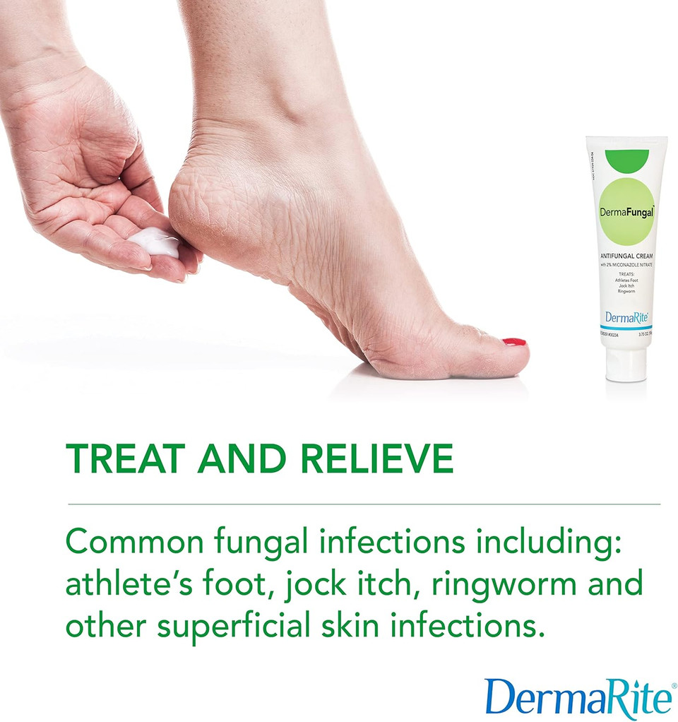 Dermafungal Antifungal Cream - Treats And Prevents Most AthleteS Foot, Jock Itch, And Ringworm - 2% Miconazole Nitrate  3.75 Oz Tube