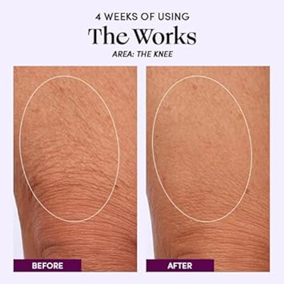 Womaness The Works All-Over Toning Body Cream  Hydrating & Smoothing Firming Body Lotion  Anti Aging Skin Tightening Cream For Body With Niacinamide & Hyaluronic Acid  Menopause Body Care  200Ml