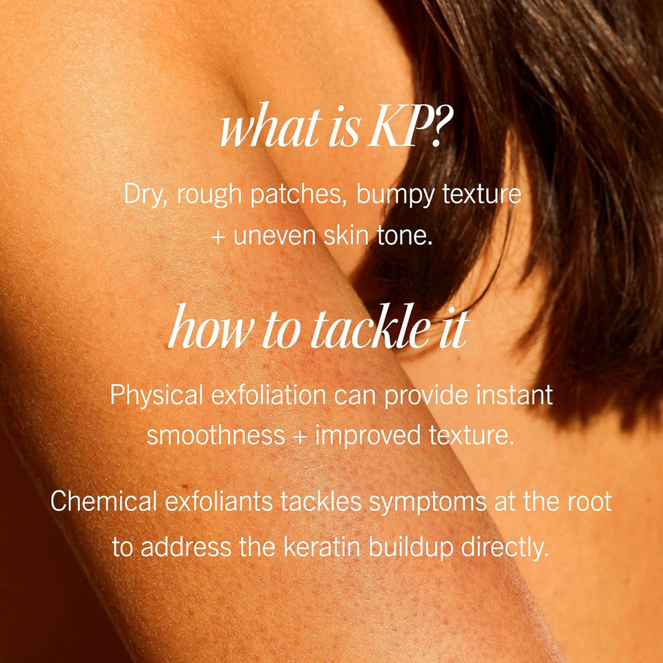 First Aid Beauty - Kp Bump Eraser Body Scrub With 10% Aha, Keratosis Pilaris Exfoliator With Glycolic And Lactic Acids, Helps Reduce Chicken Skin Bumps, Safe For Sensitive Skin, New Peach Scent (2 Oz)