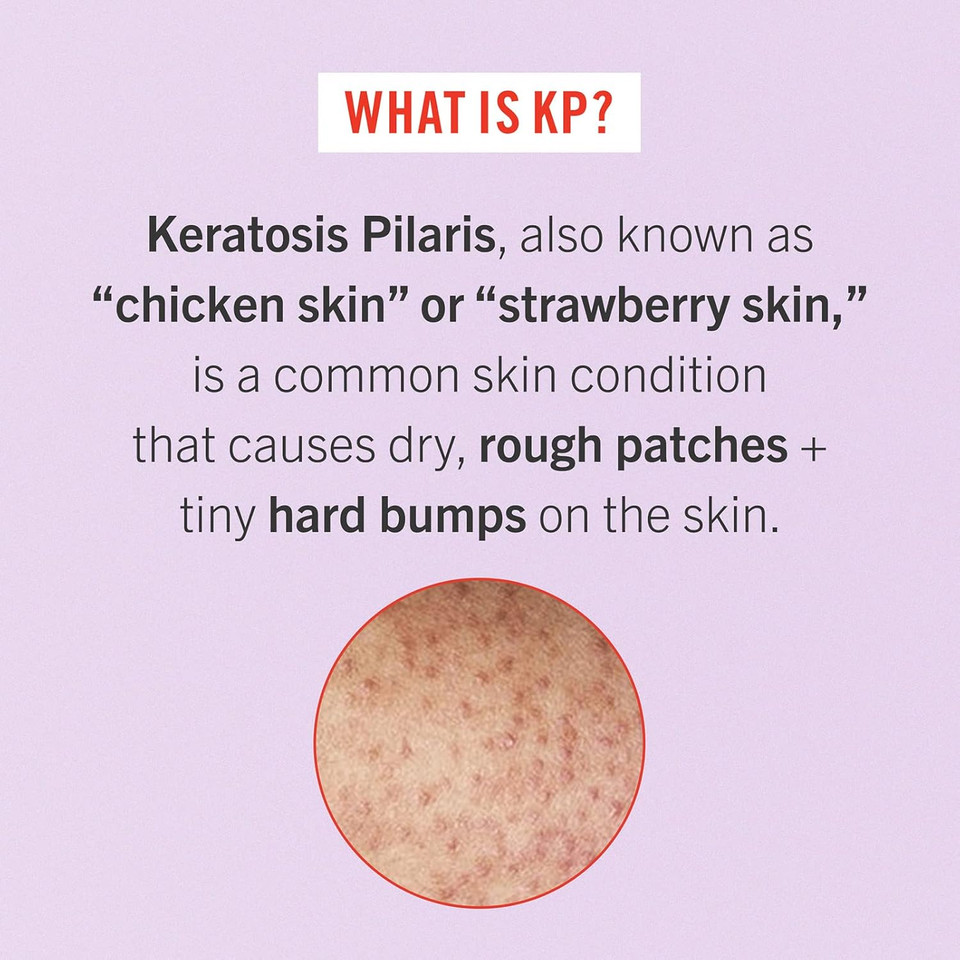 First Aid Beauty - Smooth Operators Trio: Kp Bump Eraser Body Scrub, 8 Oz, Smoothing Lotion, 6Oz, And Ingrown Hair Pads, 28 Pads, Deep Moisture Exfoliating Skin Treatment Set With Bha & Aha, 3Ct