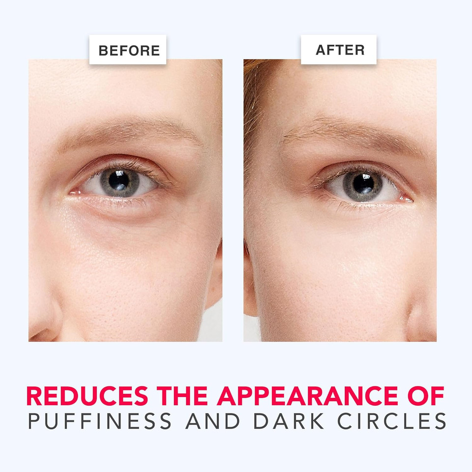 Beauty By Earth Caffeine Eye Cream For Puffiness & Bags Under Eyes - Usa Made With Natural & Organic Ingredients, Under Eye Cream For Dark Circles With Glycerin & Vitamin E, Brightens & Refreshes Beauty By Earth Caffeine Eye Cream For Puffiness & Bags Under Eyes - Usa Made With Natural & Organic Ingredients, Under Eye Cream For Dark Circles With Glycerin & Vitamin E, Brightens & Refreshes