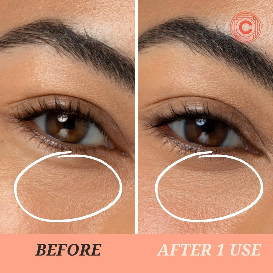 Lights On Brightening Dissolvable Eye Mask Infused With Red Algae, Vitamin C, Peptides, And Black Mulberry - Under Eye Patches For Wrinkles, Dark Circles, Puffiness, And Signs Of Aging