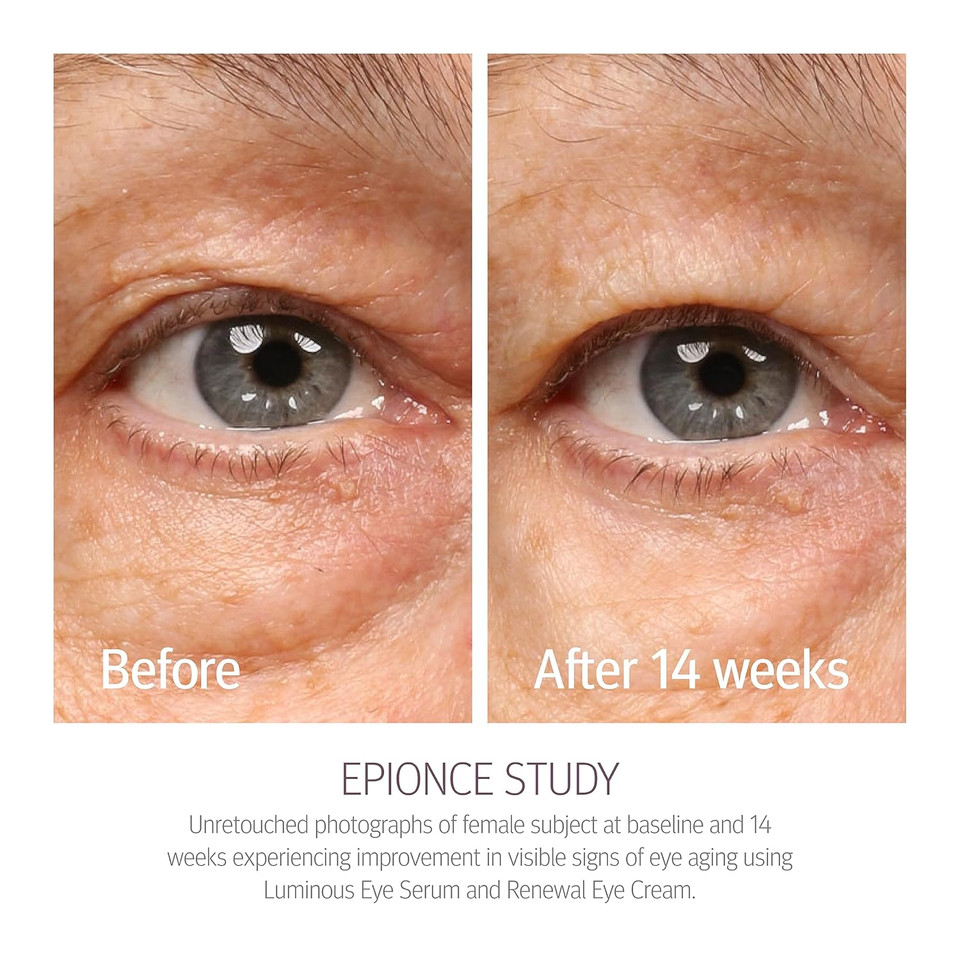 Epionce Renewal Eye Cream - Anti-Aging, Under Eye Cream For Dark Circles, Fine Lines, Wrinkles & Puffiness With Hyaluronic Acid, For All Skin Types, Dermatologist Skincare