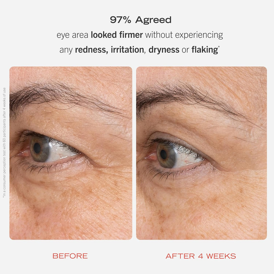 First Aid Beauty - Retinol Eye Cream With Squalane + Ceramides, Encapsulated Retinol Serum For Delicate Skin, Helps Improve Appearance Of Fine Lines And Wrinkles, Safe For Sensitive Skin, 0.5 Oz