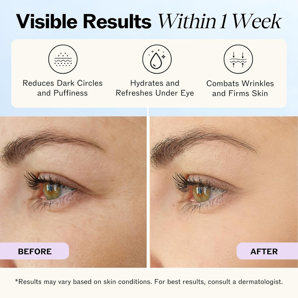 Lilyana Naturals Eye Cream For Dark Circles And Puffiness, Under Eye Cream For Wrinkles And Bags, Anti Aging - Helps Improve Dryness; For Sensitive Skin - 1.7 Oz - Made In Usa