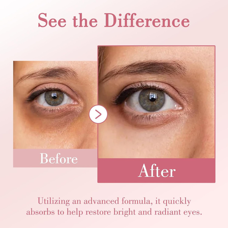 Caffeine Eye Cream 1.05 Fl Oz, Eye Cream For Fine Lines, Wrinkles, Puffiness, Dark Circles Undereye Treatment For Women & Men, Daily Eyecream For Moisturizing And Hydrating, Osp6879