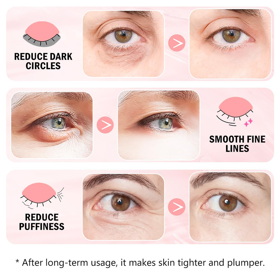 Under Eye Patches (30 Pairs) - 24K Gold Eye Mask For Puffy Eyes, Dark Circles, Under Eye Bags And Smooth Wrinkles, Eye Gel Pads With Collagen, Hyaluronic Acid & Castor Oil
