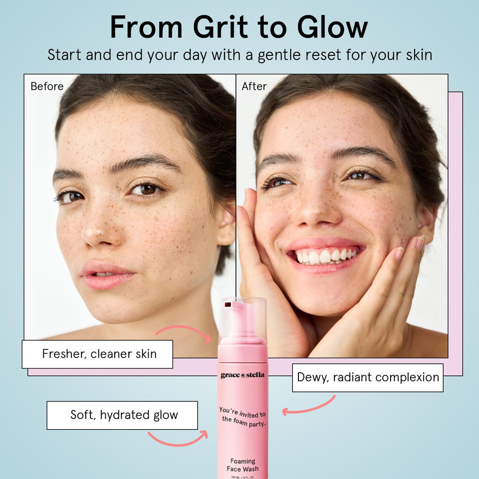 Grace & Stella Award Winning Travel Face Wash (60Ml) Hydrating & Gentle Foaming Facial Cleanser With Hyaluronic Acid, Rose Water, Aloe Vera - Moisturizing Cleansing Foam For Normal To Very Dry Skin Grace & Stella Award Winning Travel Face Wash (60Ml) Hydrating & Gentle Foaming Facial Cleanser With Hyaluronic Acid, Rose Water, Aloe Vera - Moisturizing Cleansing Foam For Normal To Very Dry Skin