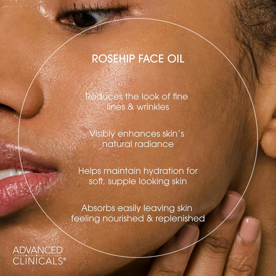 Advanced Clinicals Rosehip Oil For Face With Vitamin E + Botanicals Helps Improve Look Of Dark Spots, Wrinkles, Fine Lines, & Uneven Looking Skin Tone | Moisturizing Skin Care Face Serum, 1.8 Fl Oz