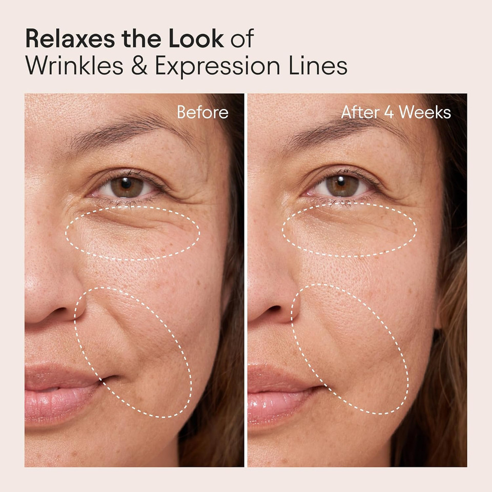 Alpyn Super Peptide & Ghostberry Moisturizer For Eczema, Barrier & Wrinkle Repair | Calm & Soothe Against Redness & Irritation | 1.7 Oz / 50 Ml