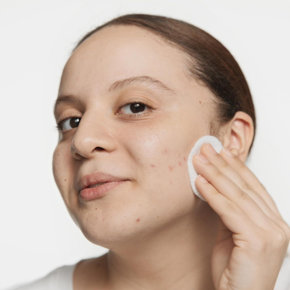 Clinique Acne Solutions Clarifying Lotion Exfoliating Facial Toner With Salicylic Acid | Reduces Oil + Unclogs Pores