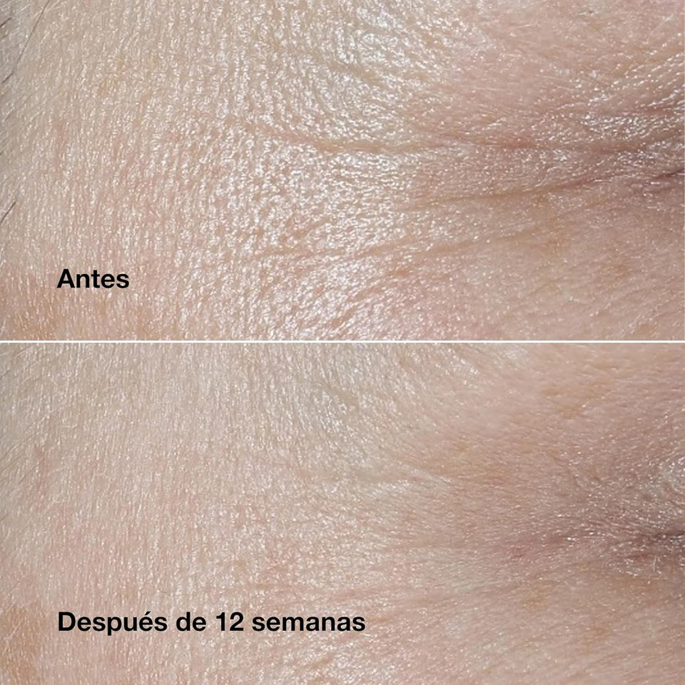 Clinique Smart Clinical Repair Wrinkle Correcting Face Cream With Hyaluronic Acid + Peptides | Anti-Aging + Hydrating