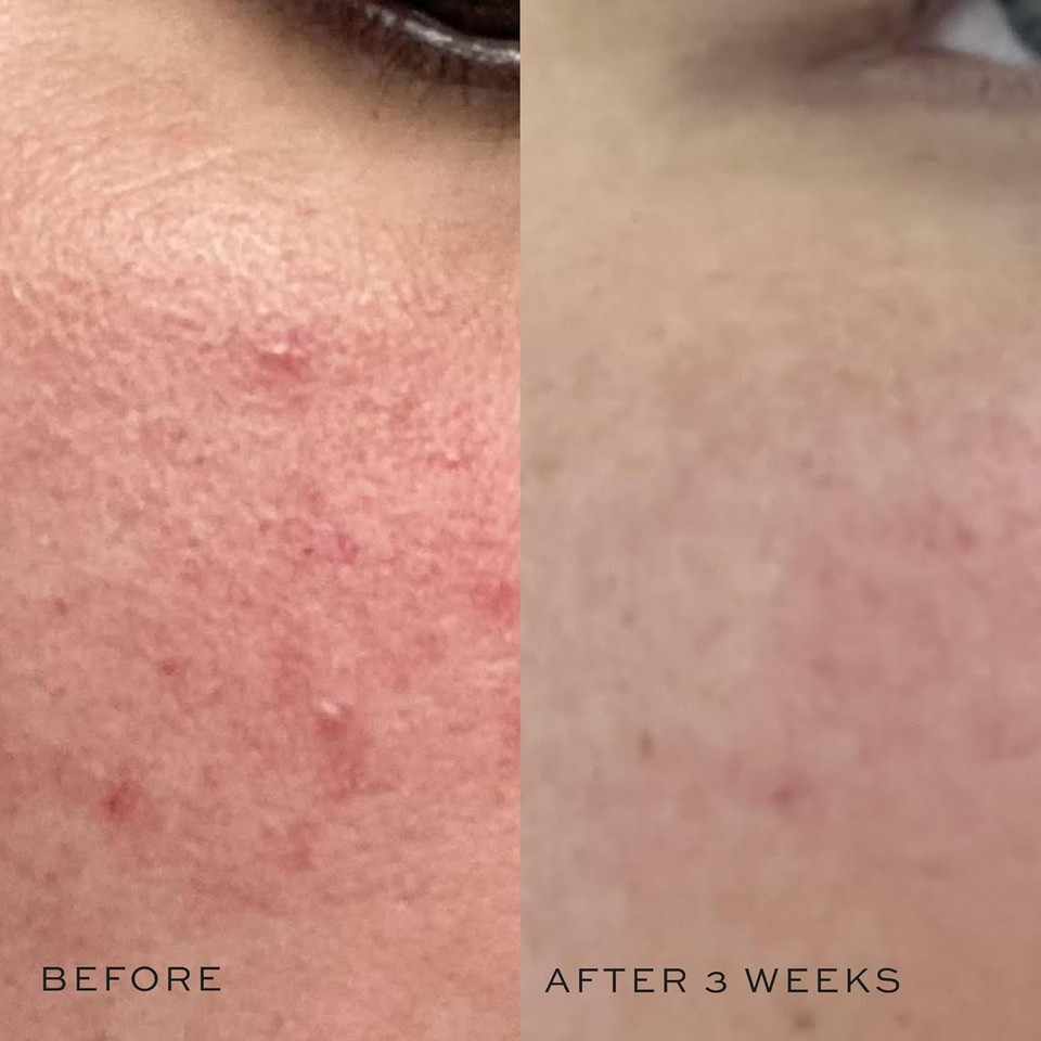 Dime Beauty Mini Super Skin Toner, Alcohol-Free Witch Hazel Toner, Travel-Size With Cucumber Extract, 2 Oz / 60 Ml