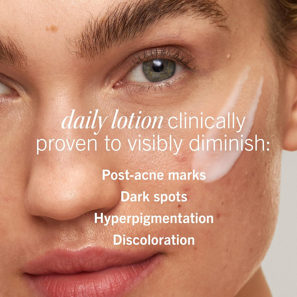 First Aid Beauty Lactic Acid Lotion For Acne-Prone Skin With 2% Niacinamide - Resurfacing Lotion Moisturizes & Visibly Diminishes Post-Acne Marks, (1.0 Oz)