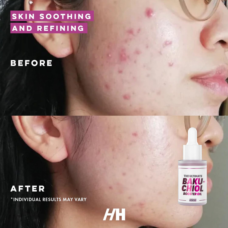 Handmade Heroes 2% Bakuchiol Oil With Sugarcane Squalane, All Natural Retinol Alternative Facial Oil For Radiant And Line Smoothing, Travel Size Skincare 0.3 Fl Oz