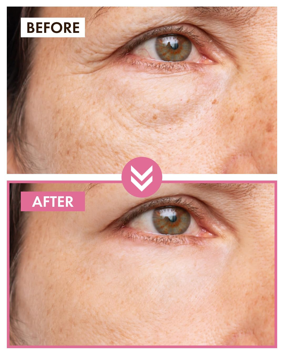 It'S Skin Peptide Collagen Moisturizer 1.69 Fl Oz. | Collagen Face Cream & Organic Face Moisturizer | Face Wrinkle Cream & Lightweight Moisturizer For Face | Korean Face Cream & Face Wrinkle Remover