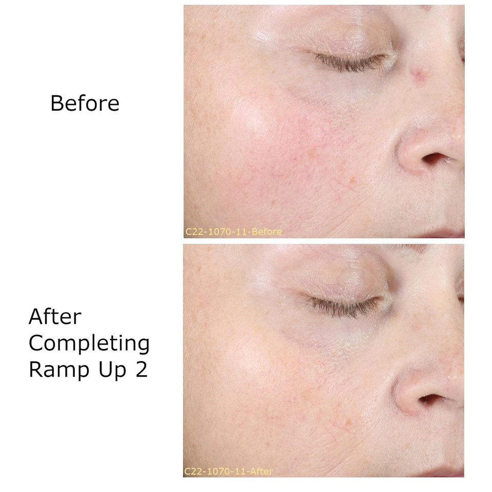 0.05% Retinol Cream, R2 Night Cream For Face, Skin Care Routine, Daily Face Moisturizer, Contains Vitamin C & Bakuchiol, Brighten & Rejuvenation *Activator Sold Separately