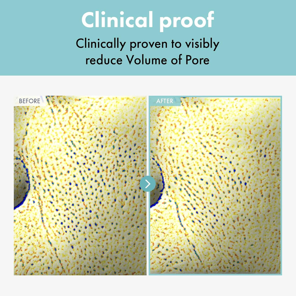 Pore Refiner Cream, Face Cream, Pore Extractor, Pore Minimize & Reducer And Remover. Best Pore Minimizer Treatment. Moisturizer For Oily Skin. K Beauty, Korean Skincare, 50G, 1.76 Oz Pore Refiner Cream, Face Cream, Pore Extractor, Pore Minimize & Reducer And Remover. Best Pore Minimizer Treatment. Moisturizer For Oily Skin. K Beauty, Korean Skincare, 50G, 1.76 Oz