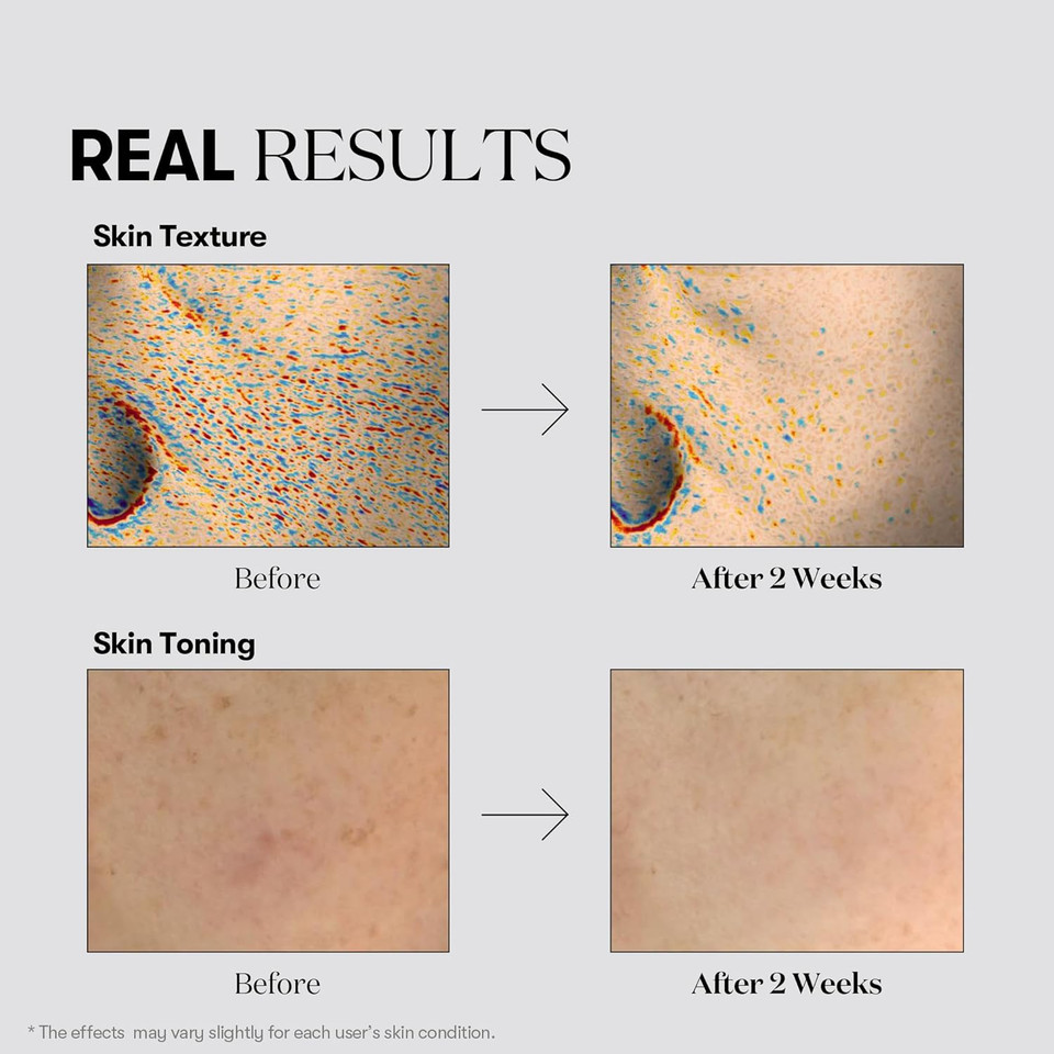 Vt Cosmetics Tx Toning Facial Toner With Tranexamic Acid, Niacinamide, Glutathione, Hydrating, Refreshing Toner For Dark Spots, Acne Scar, Sun Spots, Age Spots, Korean Skin Care (6.76 Fl. Oz.)