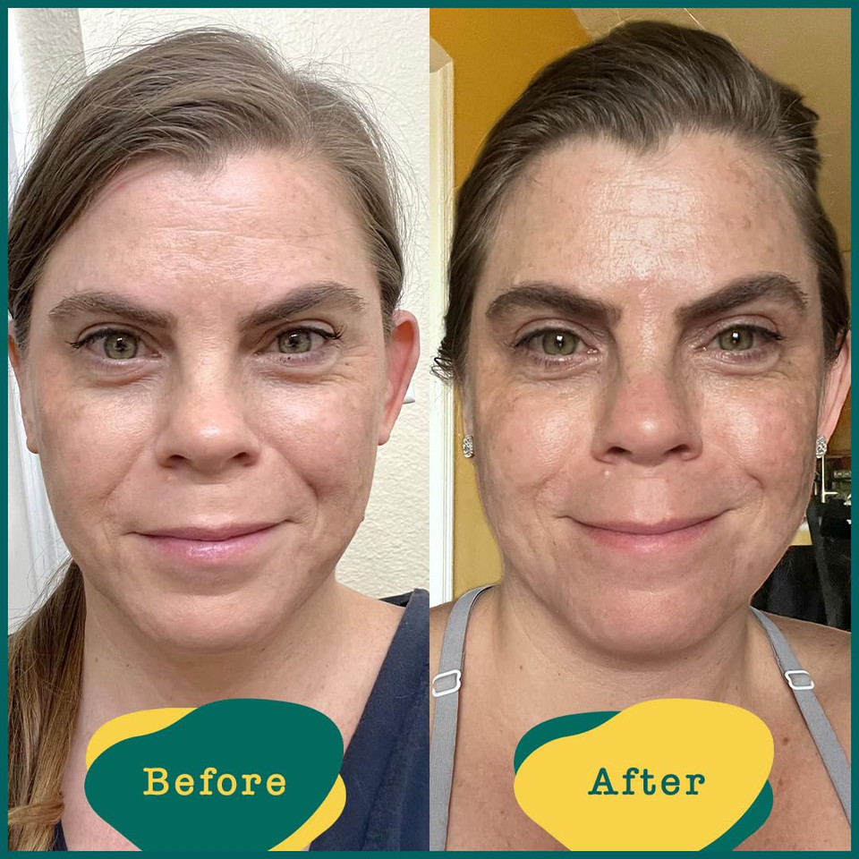 Aha Seaweed Gel W/Lactic Acid: Rinse-Off Resurfacing Chemical Exfoliant For A Renewed Complexion, 2 Fl. Oz