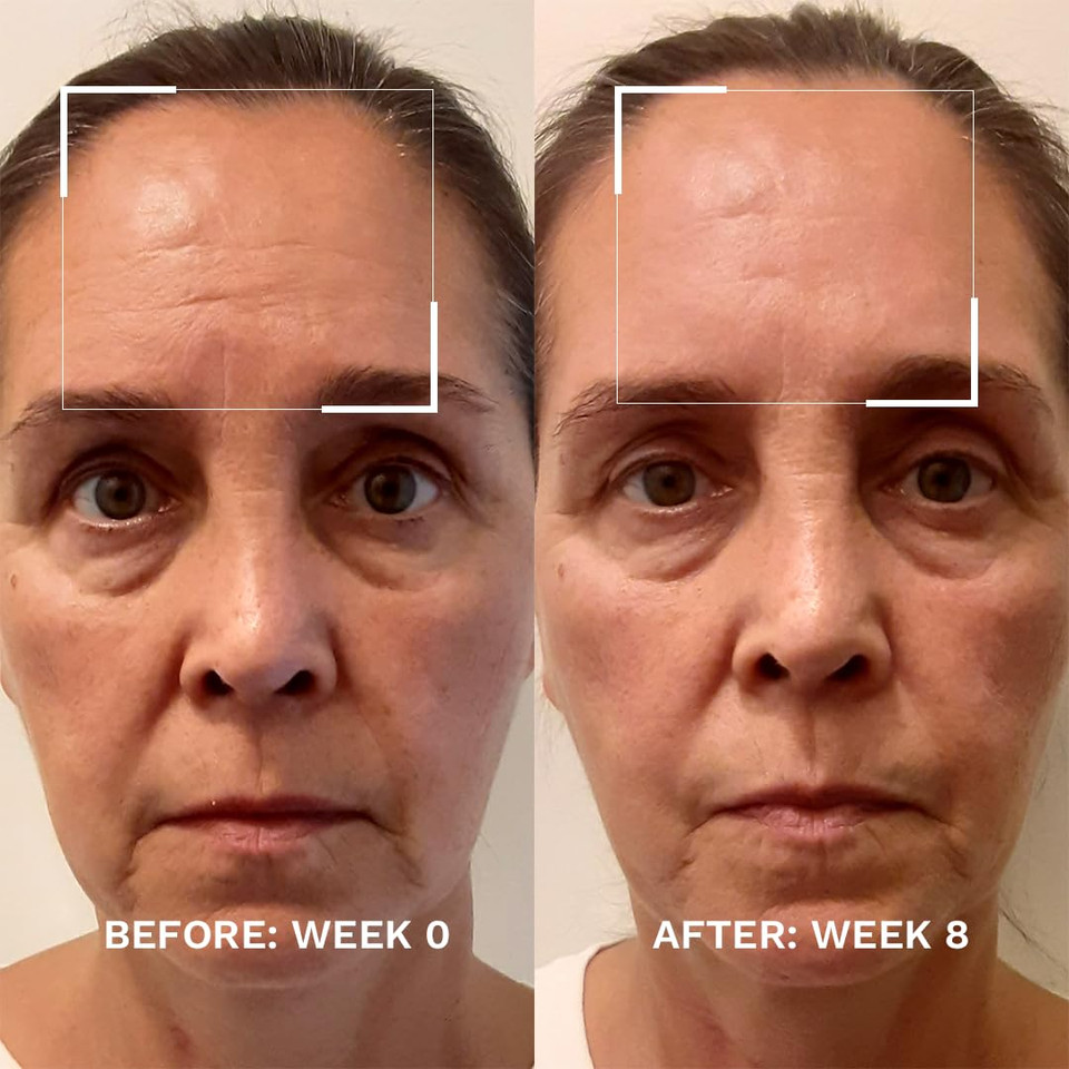 City Beauty Skin-Lifting Booster - Anti-Aging Booster Serum For Face - Lift & Tighten - Sagging Skin Solution With Peptides - Visibly Smooth Fine Lines & Wrinkles - Cruelty-Free, Clean Skin Care