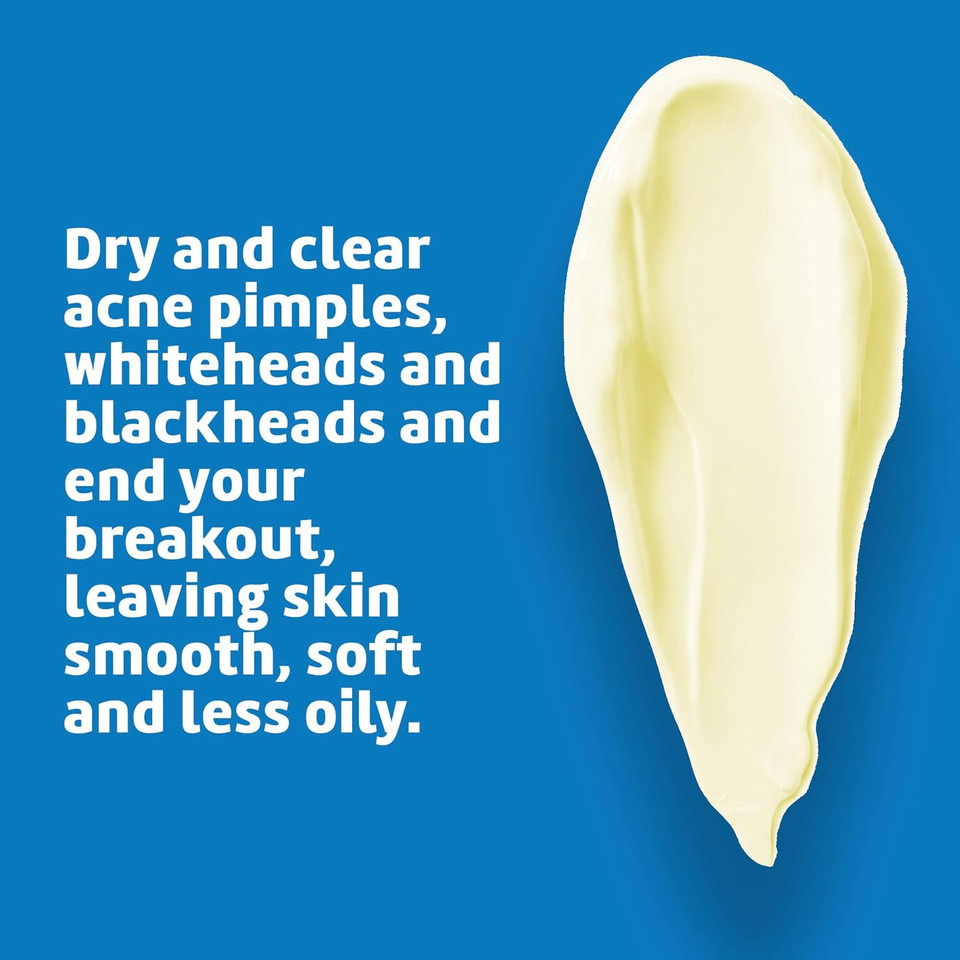 De La Cruz Sulfur Ointment - Cystic Acne Treatment For Face And Body - Daily 10 Min Spot Treatment Mask - Safe And Effective Game Changing Hormonal Acne Treatment That Clears Up Pimples - 2.6 Oz Tube