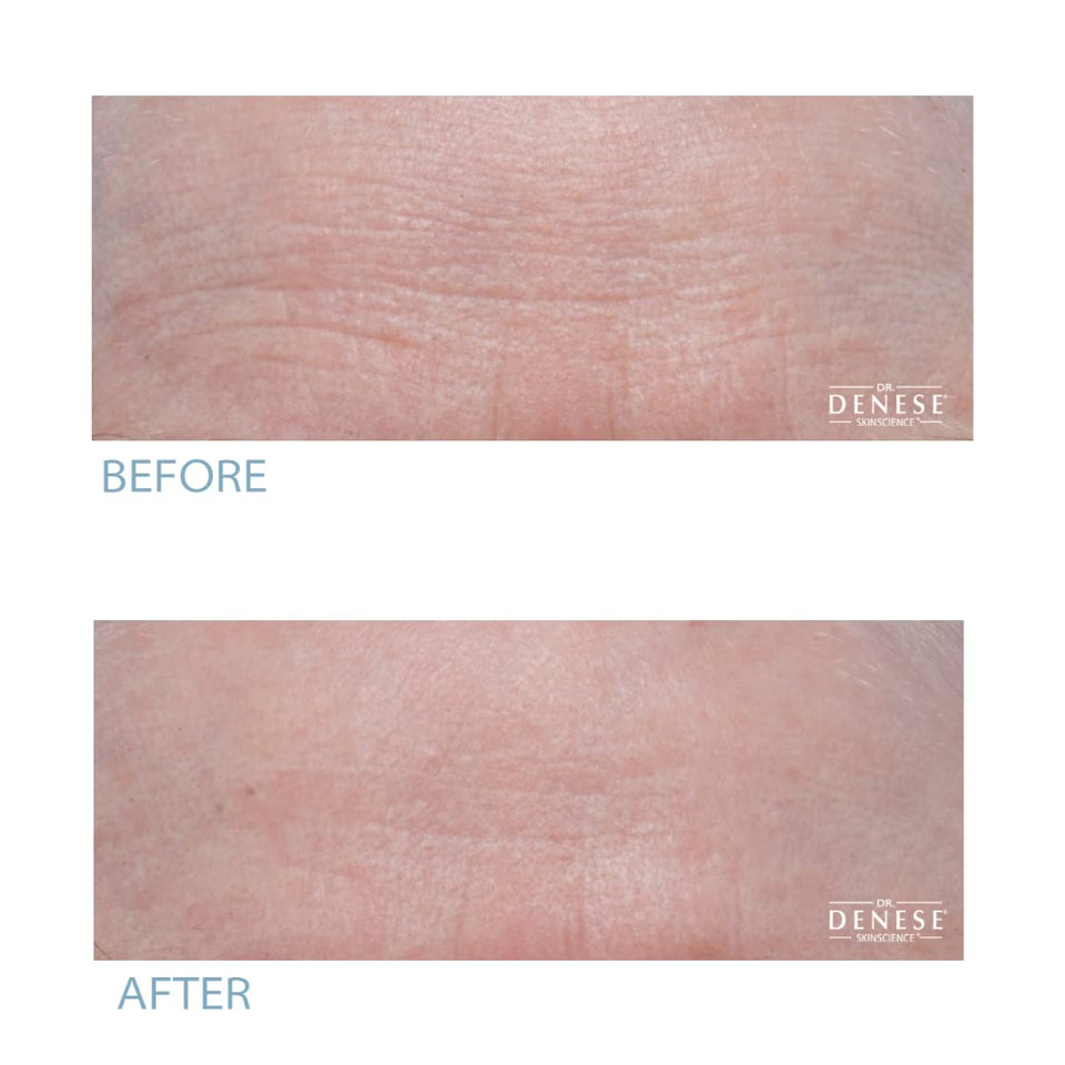 Dr. Denese Hydroshield Pro Strength Serum
