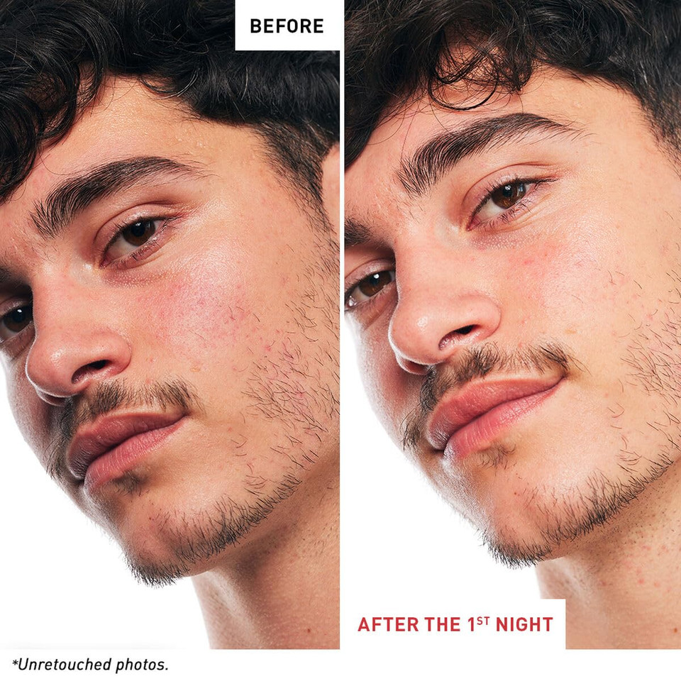 Erborian Skin Therapy Night Serum, For Wrinkles & Even Texture, Visible Results After 1St Night, Hydrating, 10% Pha & Hyaluronic Acid, Korean Skincare