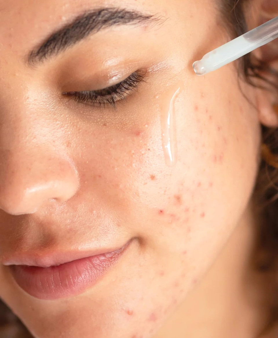 Ere Perez - White Tea Phyto Retinol Elixir | Hydrate, Plump, Soften | Bakuchiol, Resveratrol, Niacinamide | Vegan, Cruelty-Free, Clean Beauty Safe For All Skin Types (1 Fl Oz | 30 Ml)