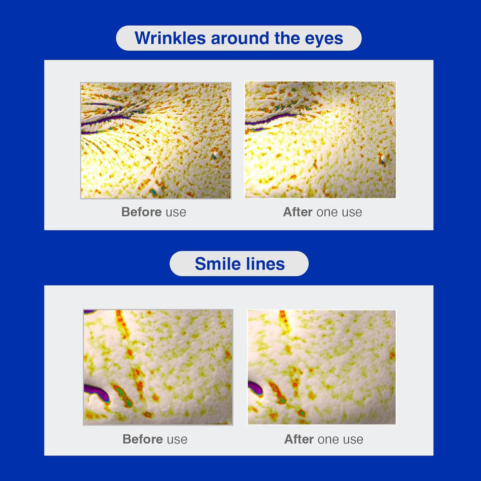 Iope Retinol Serum In Deep Collagen Gel Mask 5+1 Set | Double-Layered Hydrogel Sheet For High Adhesion, A Full Bottle Of Retinol Rx 1% Serum, Intense Firming & Plumping, Anti-Aging, Korean Skincare