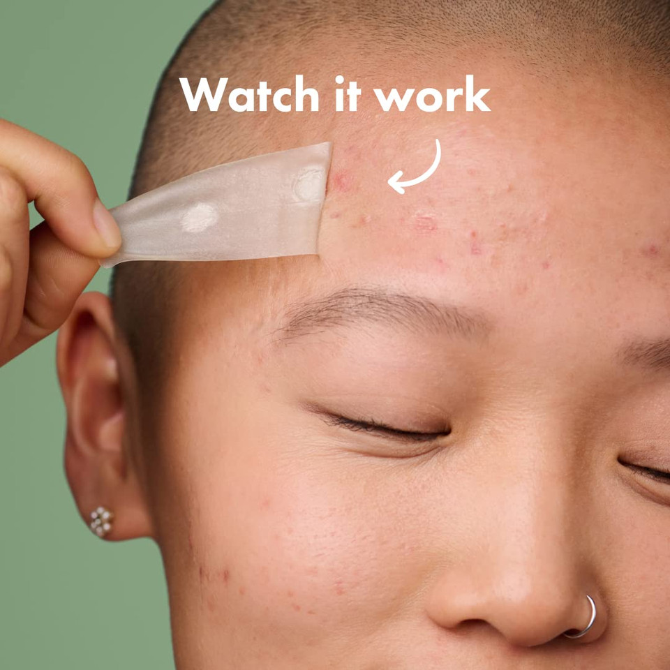 Mighty Patch Hero Cosmetics Surface Patch - Large Hydrocolloid Spot Patch For Body, Cheek, Forehead, And Chin (10 Count)