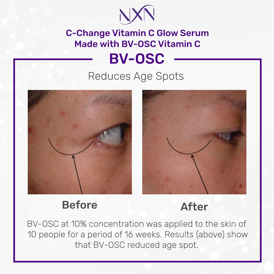 Nxn Vitamin C & Hyaluronic Acid Serum Set, Clinically Proven To Brighten Skin, Reduce Dark Spots, Improve Hyper Pigmentation Age Spots, Reduce Fine Lines & Wrinkles - 1Fl Oz Face Kit