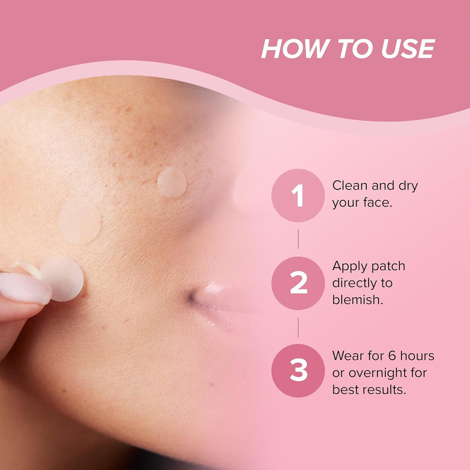 Skin Gym Pimple Poof Acne Patches, Hydrocolloid And Salicylic Acid Blemish Patches For Overnight Skin Care, 24 Count