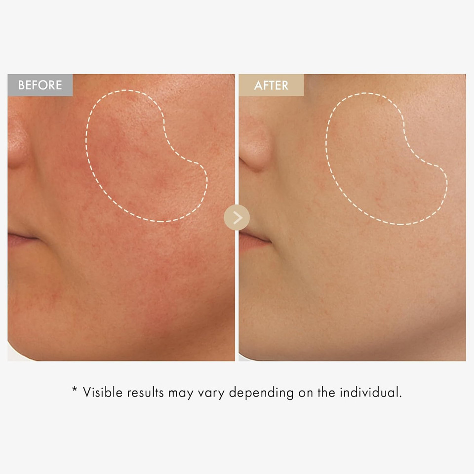 Real Rice Glow Serum With 80% Rice Bran Water And Niacinamide For Dark Spots, Uneven Skin Tone, Dull Skin, Radiant Glow, And Daily K-Beauty Skincare For All Skin Types, 33Ml / 1.11 Fl. Oz