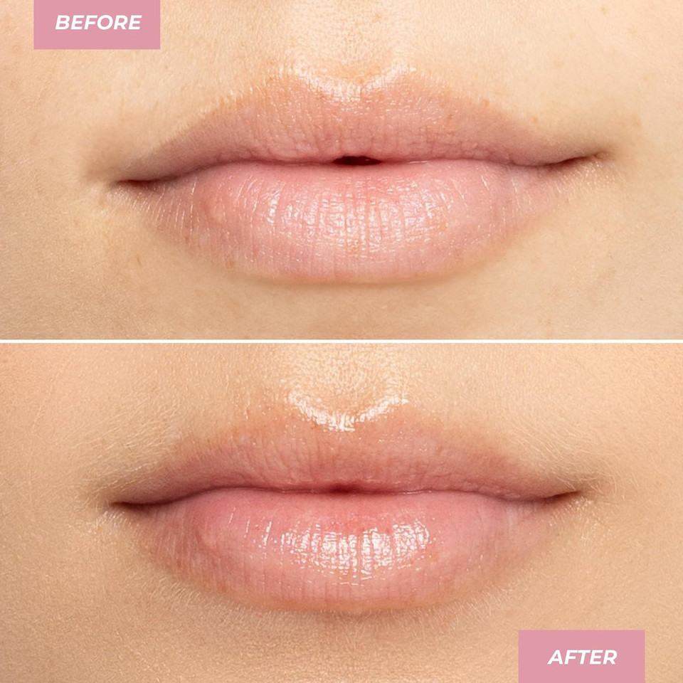 Mcobeauty Butter Lip Balm - Birthday Cake, Hydrating Lip Care, Vegan, Cruelty Free Cosmetics