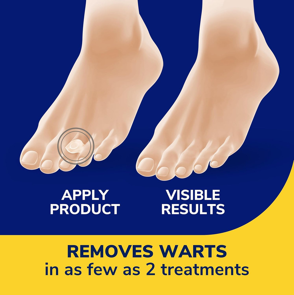 Dr. Scholl'S One-Step Wart Removers, 14 Ct // Removes Warts In As Few As 2 Treatments, Maximum Strength, Easy One-Step Application, Stays On All Day