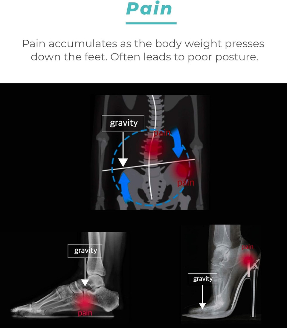 Arch Support Insoles For Men Women. Reduce Weight Burden Of Your Feet, Relieve Pain. Posture Corrector For Men Women (Mens 6 / Womens 7.5)