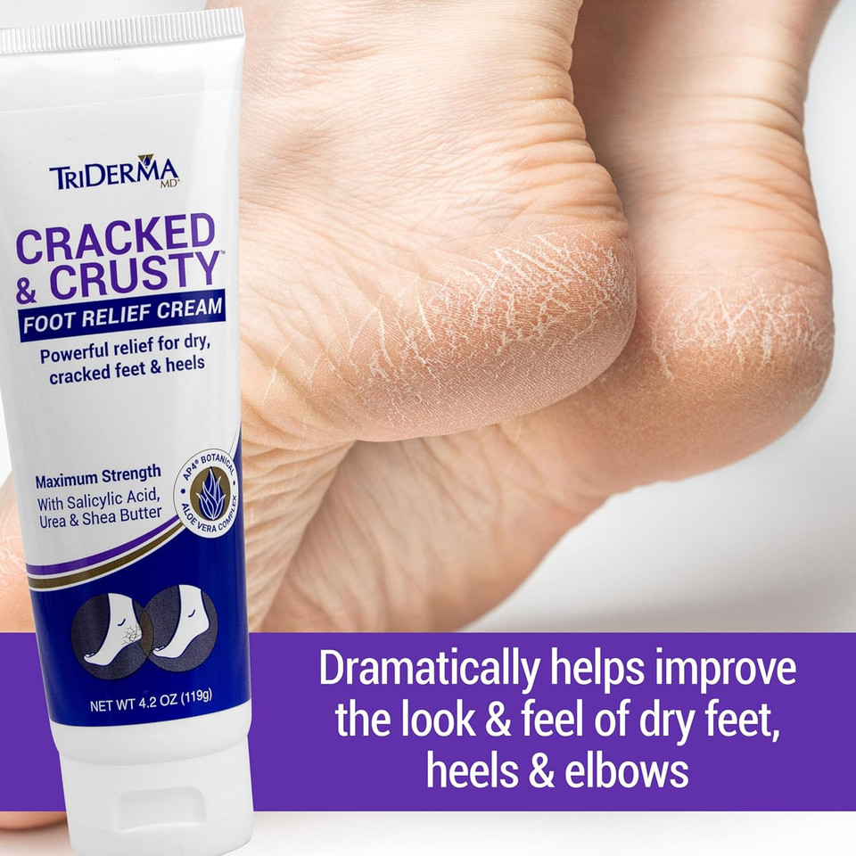Triderma Cracked & Crusty Healthy Foot Cream Moisturizes, Softens And Heals Dry Feet, Cracked Heels And Dry Elbows With Salicylic Acid, Urea, Shea Butter, Ap4 Aloe And Vitamins, 4.2 Ounces Triderma Cracked & Crusty Healthy Foot Cream Moisturizes, Softens And Heals Dry Feet, Cracked Heels And Dry Elbows With Salicylic Acid, Urea, Shea Butter, Ap4 Aloe And Vitamins, 4.2 Ounces