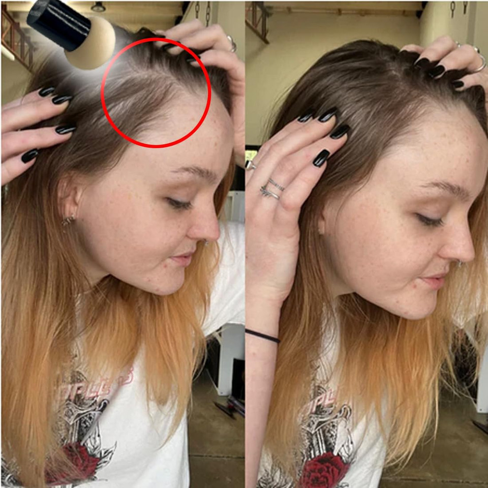 Keratin Research Hairline Filler Unisex Mineral Powder Root Touch-Up Hair Loss Concealer Scalp & Beard Bald Patch Coverage Fibers For Thinning Hair Waterproof Organic Natural Look (Dark Blonde, Xl)