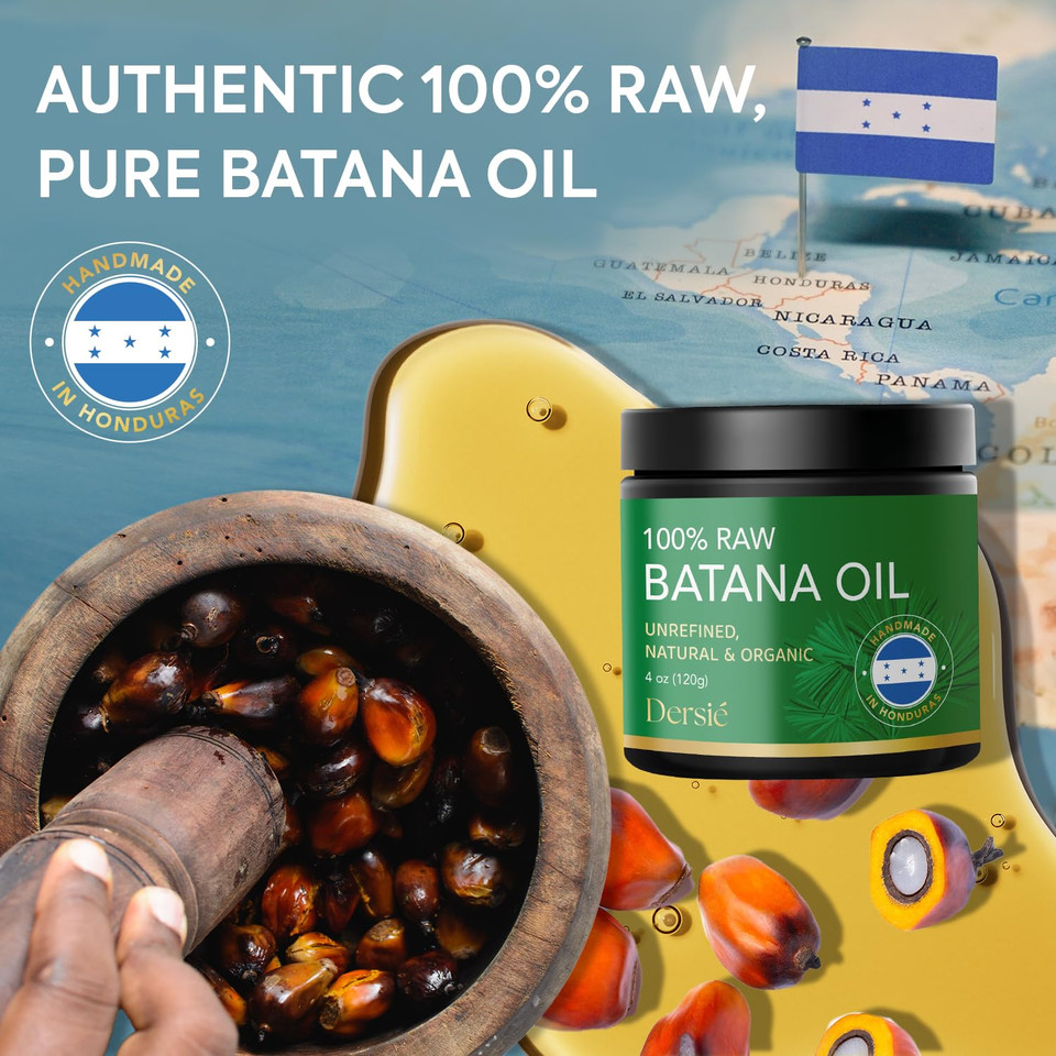 Authentic Batana Oil For Hair Growth: Handmade In Honduras 100% Raw Batana Oil - 100% Pure & Natural, Unrefined - Approved By Dr. Sebi For Thicker, Stronger, Fuller Hair - 4 Oz Authentic Batana Oil For Hair Growth: Handmade In Honduras 100% Raw Batana Oil - 100% Pure & Natural, Unrefined - Approved By Dr. Sebi For Thicker, Stronger, Fuller Hair - 4 Oz
