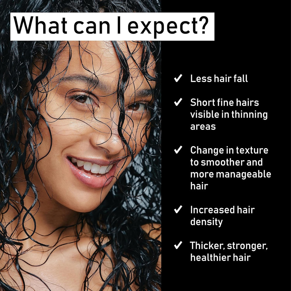Evolis Reverse Activator Hair Growth Treatment - Keratin Treatment For Thinning Hair - Accelerates Hair Growth And Decreases Hair Fall - Hair Thickening Scalp Activator (1.7 Fl Oz) Evolis Reverse Activator Hair Growth Treatment - Keratin Treatment For Thinning Hair - Accelerates Hair Growth And Decreases Hair Fall - Hair Thickening Scalp Activator (1.7 Fl Oz)