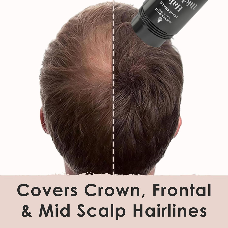 Hair Fibers For Thinning Hair For Women, Men. Plant-Based Formula For Instant Hairline & Bald Spot Coverage. Non-Itchy, Easy To Wash Out (Black)
