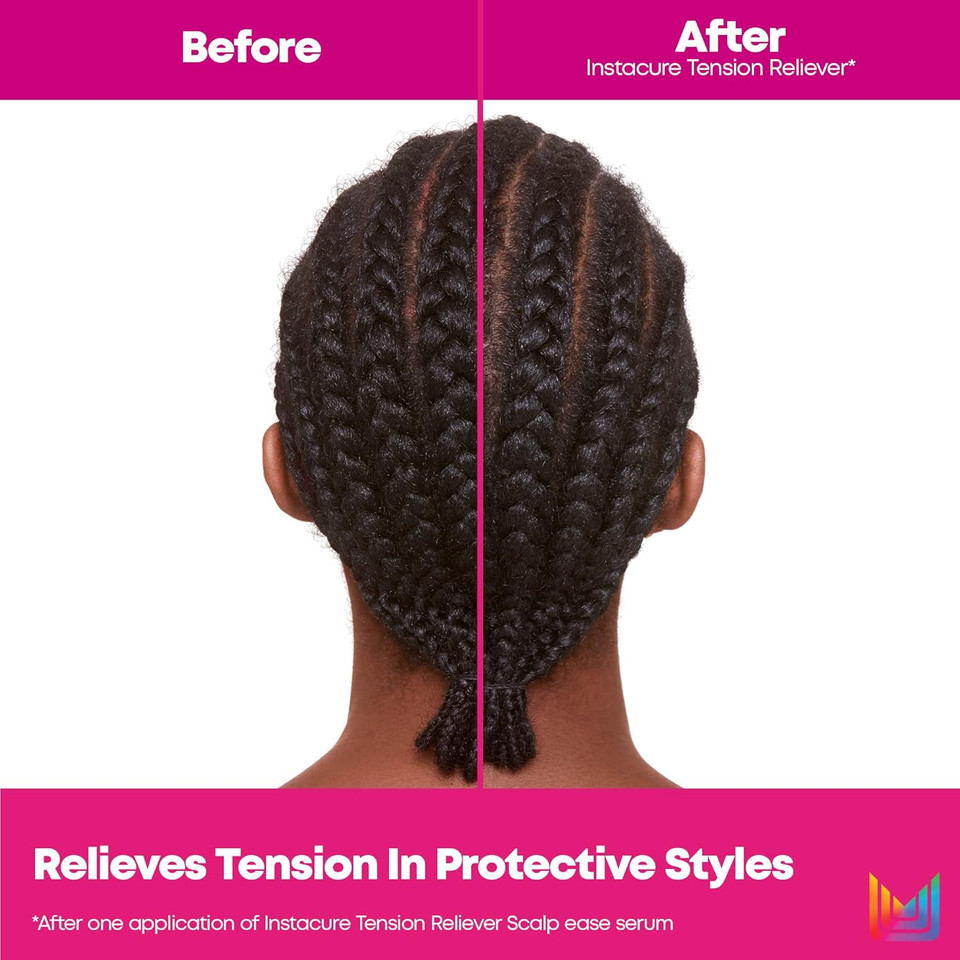 Matrix Instacure Tension Reliever Leave-In Scalp Serum - Moisturizes Dry And Irritated Scalp, Cools Tension In Braids, Protective & Tight Hairstyles, 6.8 Fl Oz