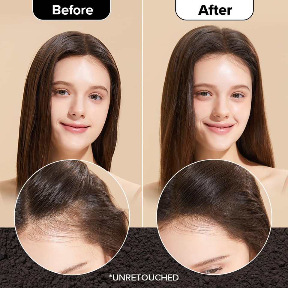 I Dew Care Biotin Clarifying Dry Shampoo - Tap Secret Dark Brown | Strengthening & Volumizing, Powder Type, Refillable, Travel Size, Non-Aerosol, Brunette, Korean Ginseng, 0.24 Oz I Dew Care Biotin Clarifying Dry Shampoo - Tap Secret Dark Brown | Strengthening & Volumizing, Powder Type, Refillable, Travel Size, Non-Aerosol, Brunette, Korean Ginseng, 0.24 Oz