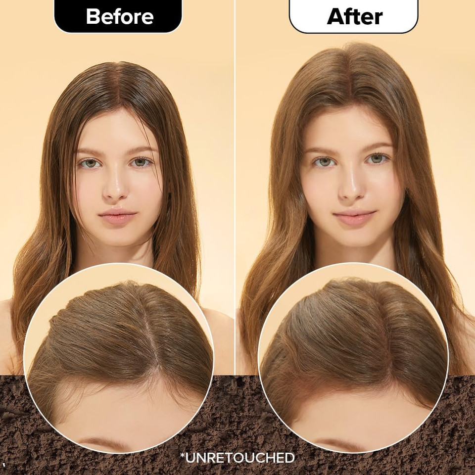 I Dew Care Biotin Clarifying Dry Shampoo Refill - Tap Secret Original | Strengthening & Volumizing, Powder Type, Refillable, Travel Size, Non-Aerosol, Brunette, Korean Ginseng, 0.24 Oz I Dew Care Biotin Clarifying Dry Shampoo Refill - Tap Secret Original | Strengthening & Volumizing, Powder Type, Refillable, Travel Size, Non-Aerosol, Brunette, Korean Ginseng, 0.24 Oz