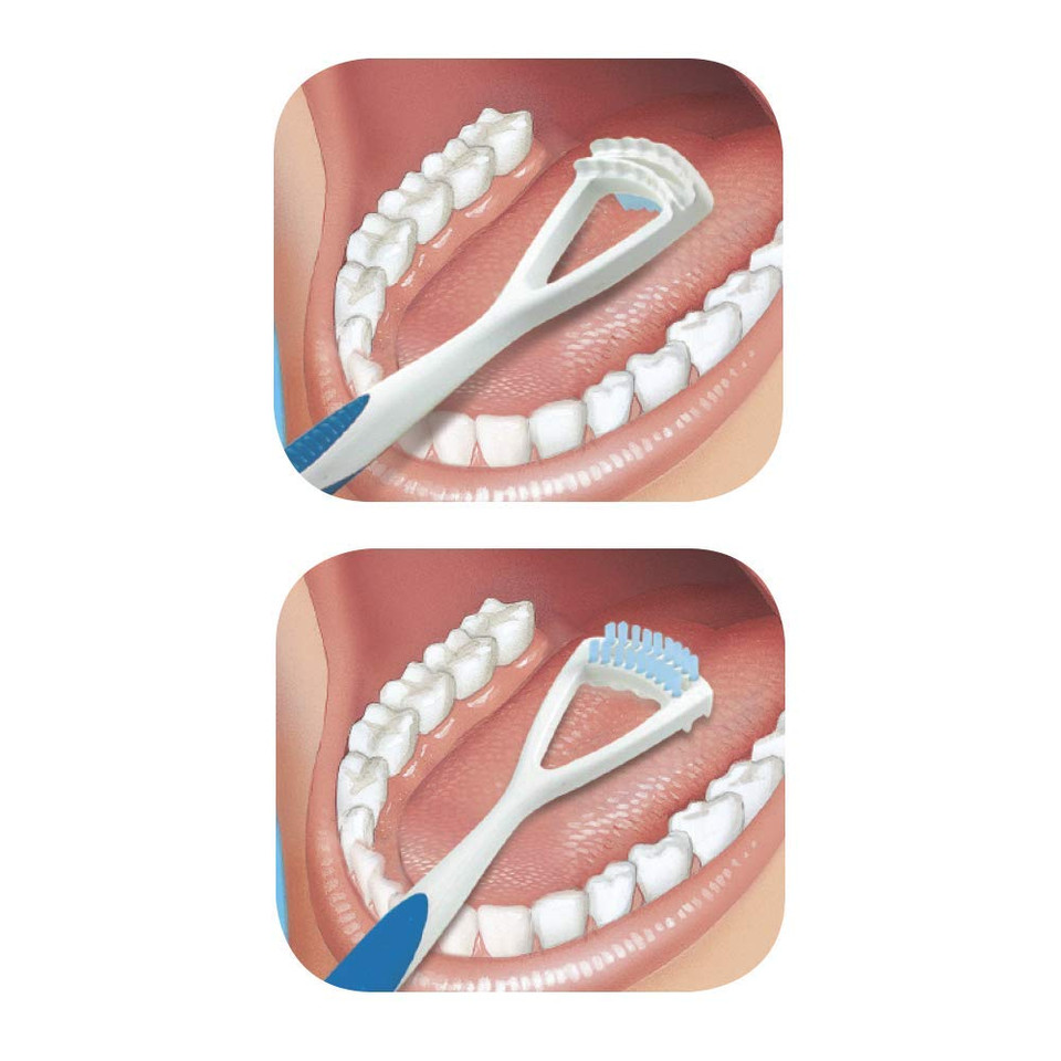 Gum - 760Rb Dual Action Tongue Cleaner Brush And Scraper (Colors May Vary)